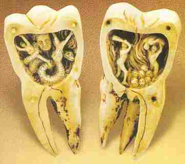 Теории происхождения кариеса зубов